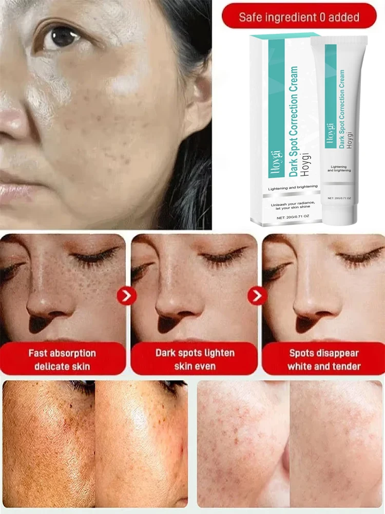 ครีมกำจัดจุดด่างดำที่มีประสิทธ - Luxury Skincare Brands บทวิจารณ์และราคา