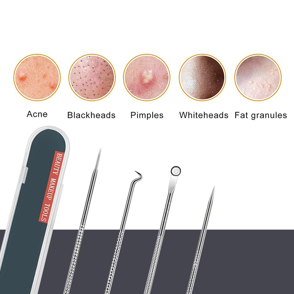 ชุดเครื่องมือกดสิว กำจัดสิวเสี - Luxury Skincare Acne บทวิจารณ์และราคา