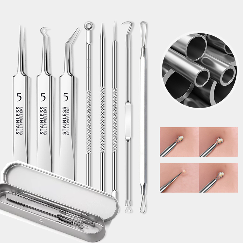 คุณภาพสูงสิว Blackhead Removal - Luxury Skincare Acne บทวิจารณ์และราคา