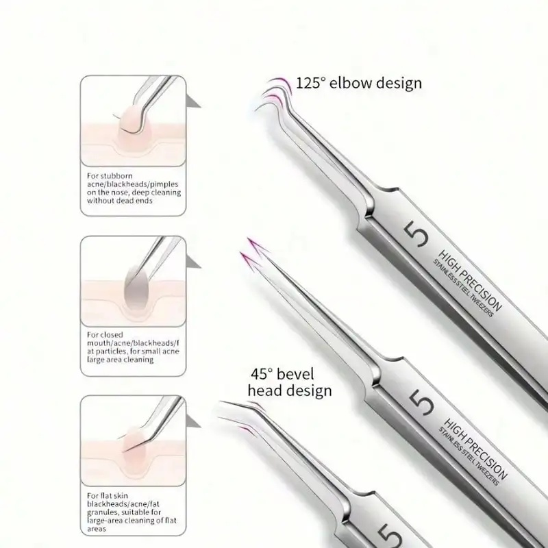 ชุดเครื่องมือกำจัดสิวเสี้ยนสแต - Luxury Skincare Acne บทวิจารณ์และราคา