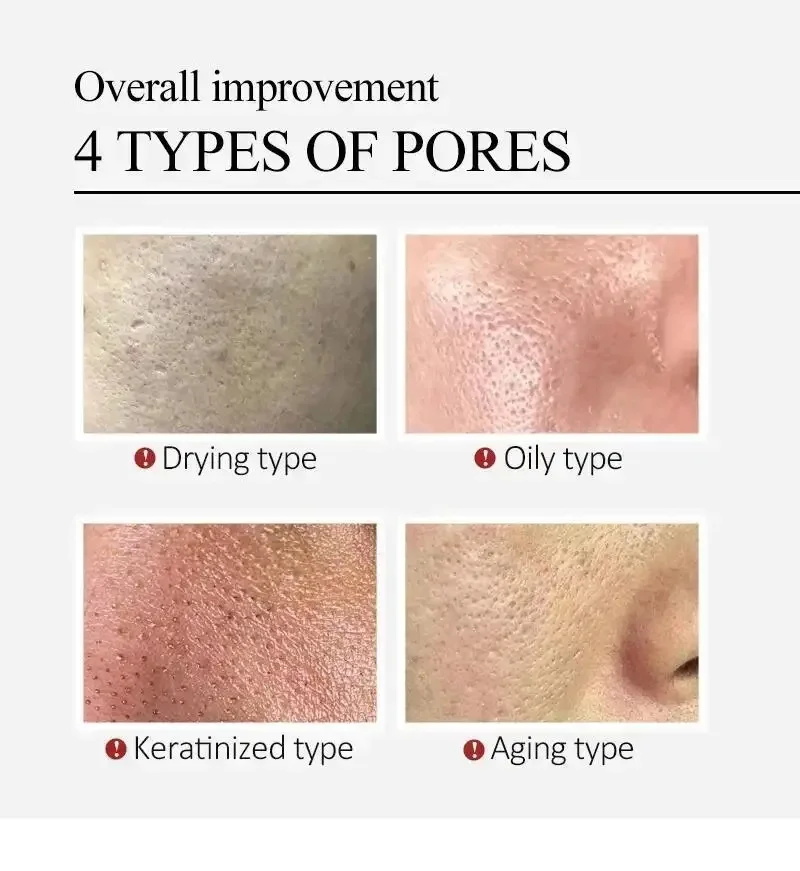 เซรั่มใบบัวบก ลดรูขุมขน ลดรอยแ - Luxury Skincare Korea บทวิจารณ์และราคา