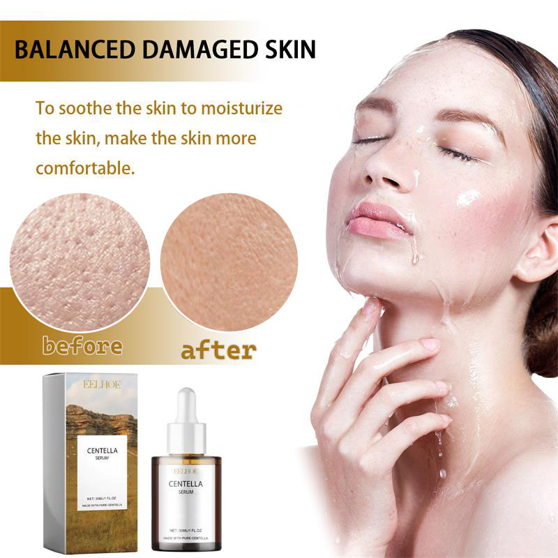 เซรั่มใบบัวบก ลดรูขุมขน ลดรอยแ - Luxury Skincare Korea บทวิจารณ์และราคา